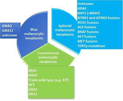 Genomic Landscape of Spitzoid Neoplasms Impacting Patient Management